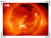 太陽 X線 写真